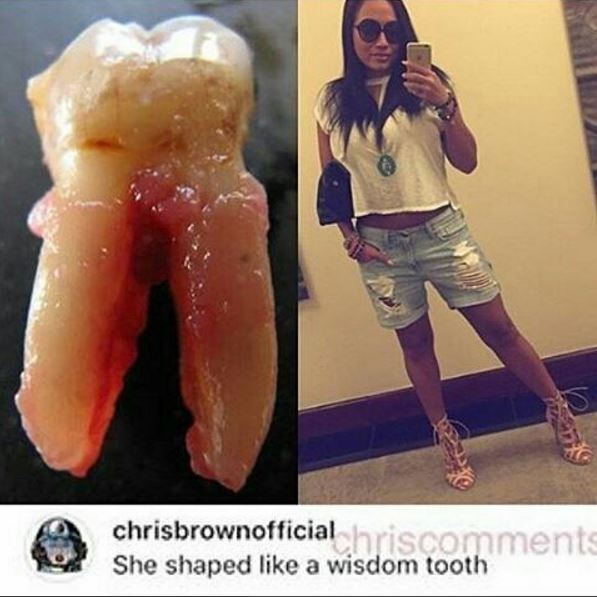 chrisbrownwisdomtoothinsultig