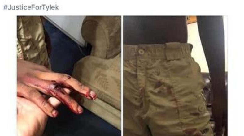 Tylek Marshall is a young man, who just graduated from high school, in Miller County, Georgia. Attending a graduation party, with friends, mostly white, he was confronted by adults who told him he didn't belong there. Arguing ensued, and Tylek Marshall attempted to get into his vehicle, and leave, but the adults cornered and beat him, even closing his hand into the door jam, leaving his hand bloodied, and feeling lost in one finger. While his friends tried to help him, he was still beaten, with one friend managing to drive him home. Marshall's father spoke out, saying he notified local law enforcement, only for them to get back to him late, later telling him they were focused on "more important" cases.