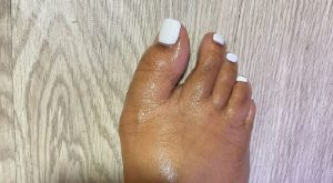 DeAndre Moore shared a photo to Facebook, of his girlfriend's toes. Jokingly, he shared this on Facebook, with her crooked toes. He said he got her toes done and wanted to know what the people thought, and the people in the Facebook comments did not hold back.