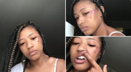 Sashé R'ki (@DaMonkeyBaby) vents, on Twitter, about some fake friends. Her day began as any other day would, initially, going out for brunch with "friends," in Stamford, Connecticut. However, she wakes up in a hospital, on morphine, with bed restraints, and band-aids, trying to figure out what's going on. None of these so-called friends have any answers for her.