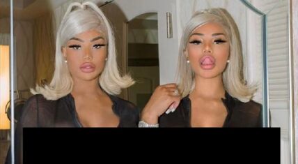 Clermont Twins have apparently had some new work done, as their hips, and thighs look very different. What they have going on, Twitter isn't a fan of. They are calling the ladies' new look "awful" and "a mess."