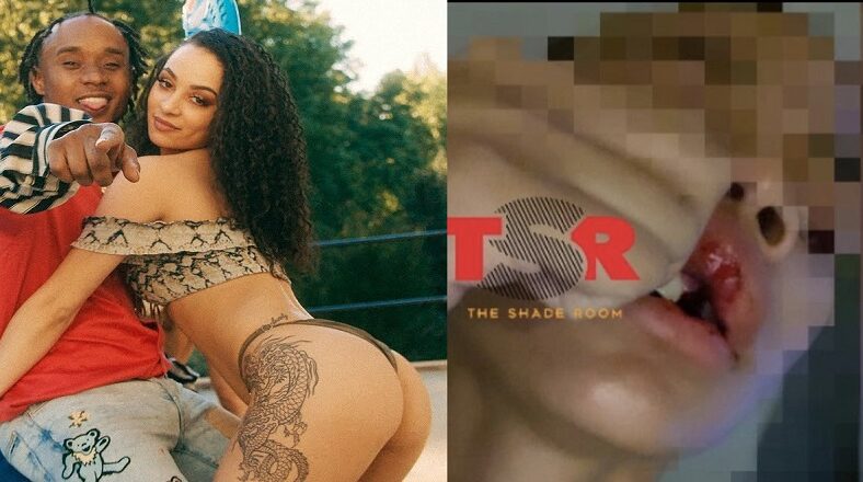 Slim Jxmmi, one half of Rae Sremmurd, is accused of beating his pregnant girlfriend. The veteran rapper is accused of knocking her teeth out, something that he denies. After seeing the story, on Instagram, Slim Jxmmi said these claims were 100% lies and that they will be hearing from his lawyers, soon.