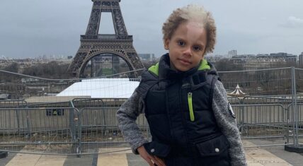 Samuel Silva modeling contract after skin condition posted by family on Instagram