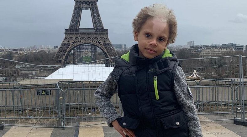 Samuel Silva modeling contract after skin condition posted by family on Instagram