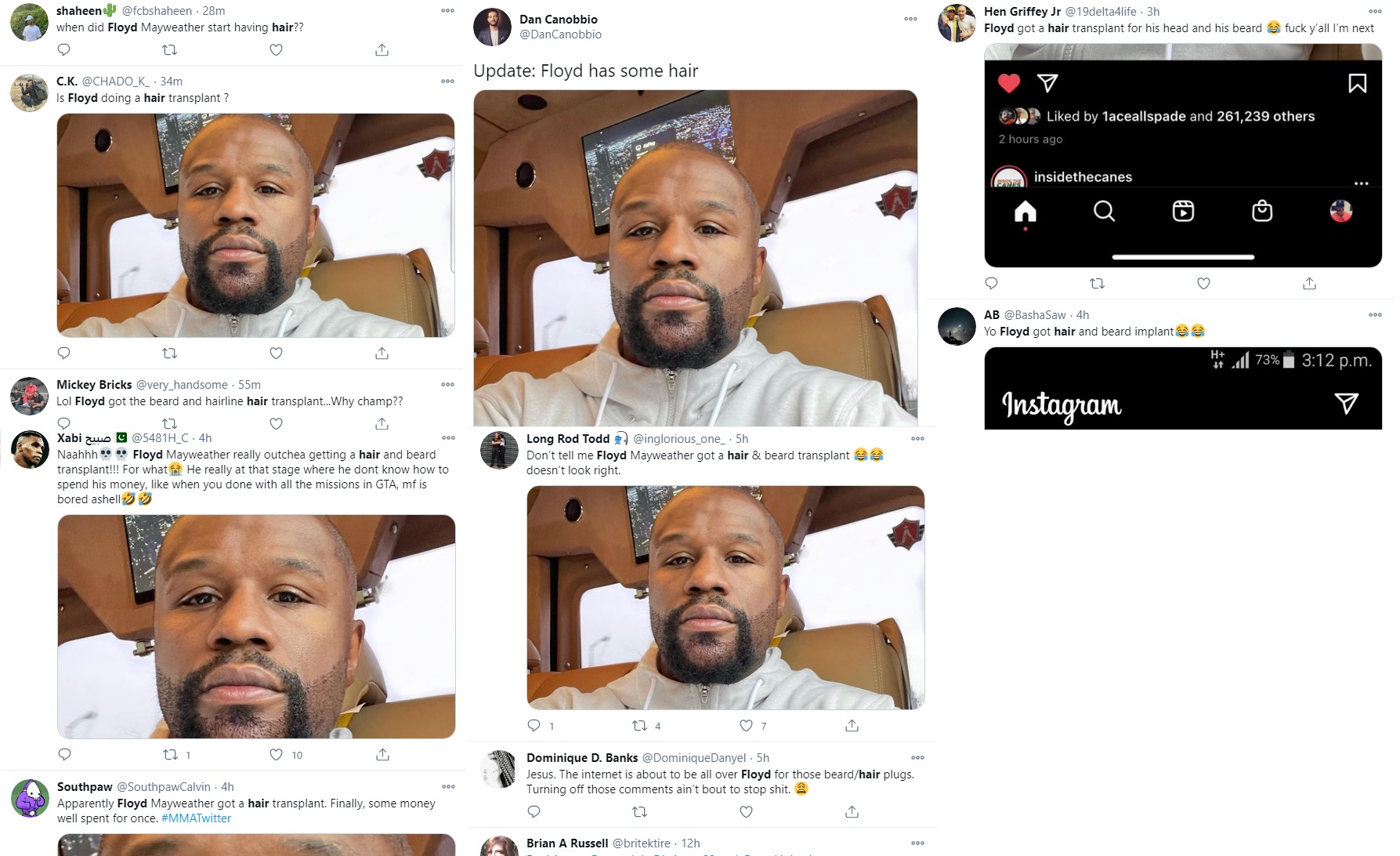 Floyd Mayweather Jr shows off new hairline