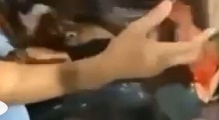 Baby Blue Whoaaa shot critical condition hospital Miami
