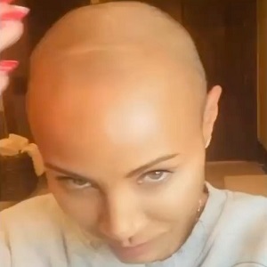 Jada Pinkett Smith reveals she has alopecia