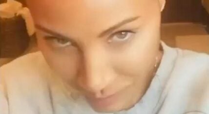 Jada Pinkett Smith reveals she has alopecia