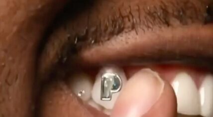 Gunna gets 100K P diamond in his tooth to celebrate Pushin P