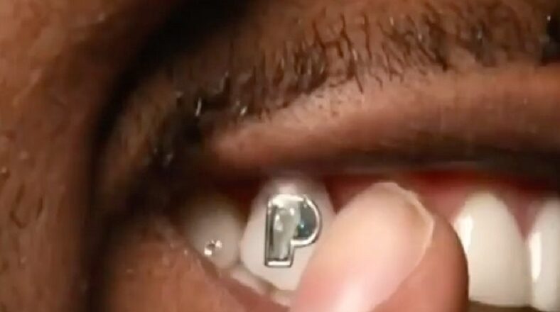 Gunna gets 100K P diamond in his tooth to celebrate Pushin P