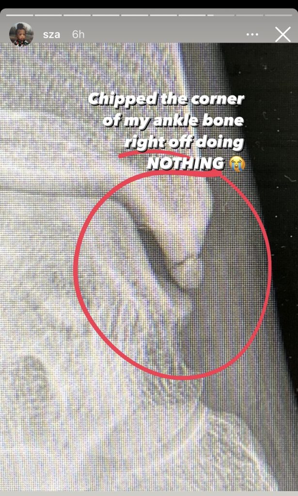 SZA says she has broken ankle after being seen with crutches at Grammys