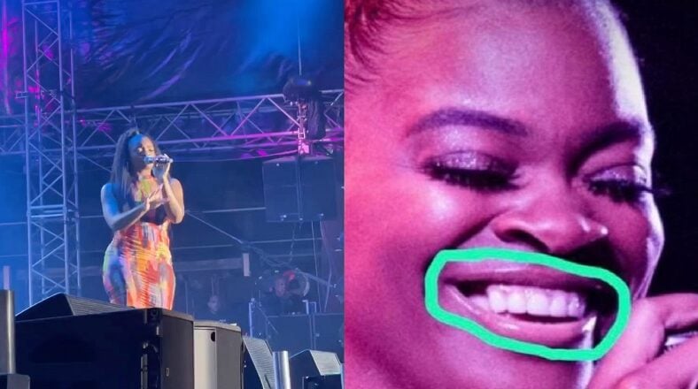 Ari Lennox gets clowned for having a missing tooth