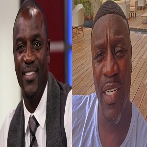 Akon appears to have gotten his hairline done in viral photo