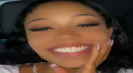 Coi Leray shows off teeth after getting braces removed