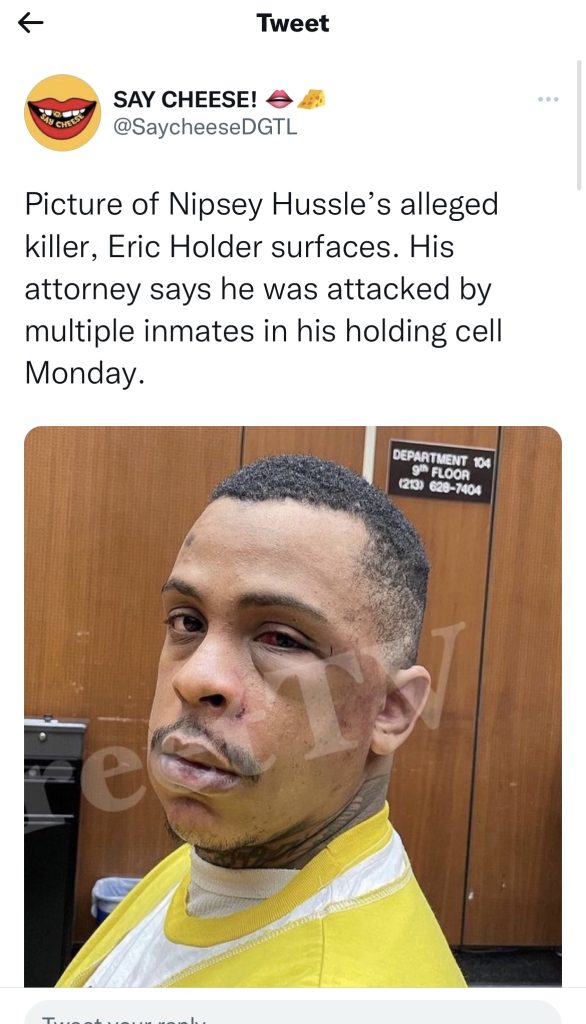 Nipsey Hussle’s killer shows off injuries after jail attack 