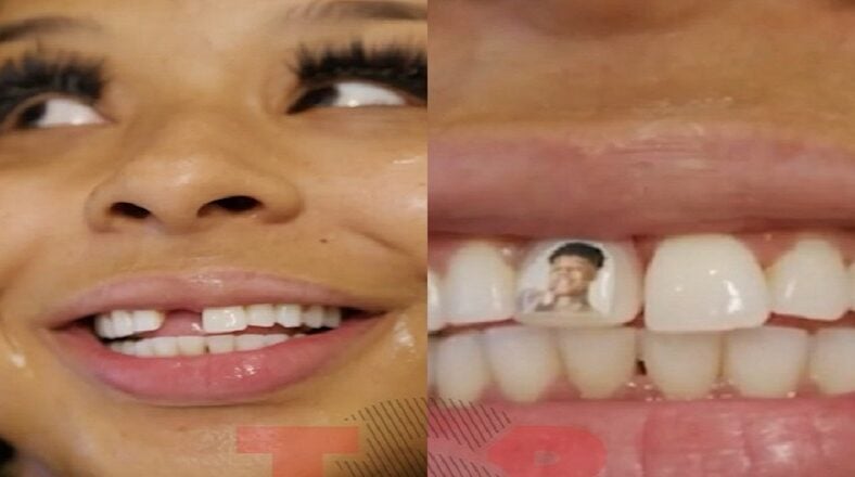 Chrisean Rock gets Blueface's photo added to her new tooth