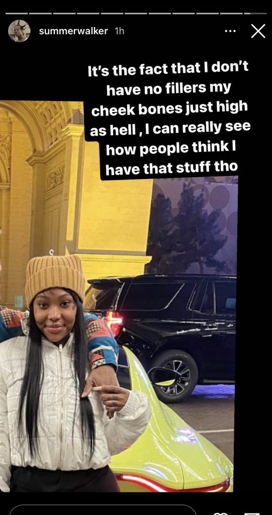 Summer Walker denies getting any fillers in her face 