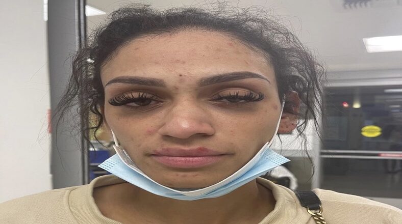 Miles Bridges' wife opens up about being attacked by Bridges