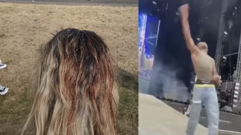 Lil Uzi Vert denies throwing cell phone at fan during performance