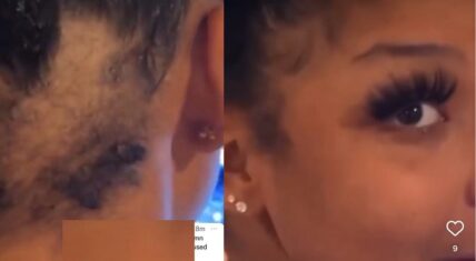 Chrisean Rock tells Blueface he gave her a bald spot