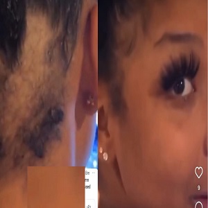 Chrisean Rock tells Blueface he gave her a bald spot