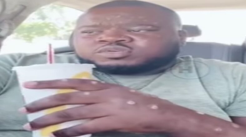 Duane Cali lied about having monkeypox to promote his music