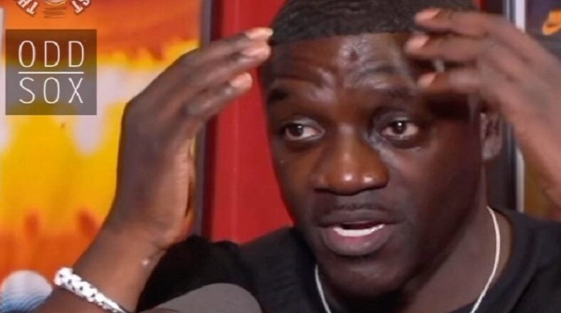Akon admits to having hair transplant and says it only cost $7500