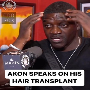 Akon admits to having hair transplant and says it only cost $7500
