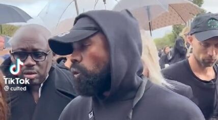 Kanye West's face looks bruised at Paris Fashion Week