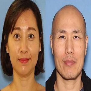 Woman buried alive by husband escapes from shallow grave