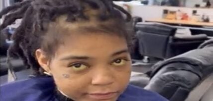 Young M.A's health is concerned by fans after noticing yellow eyes