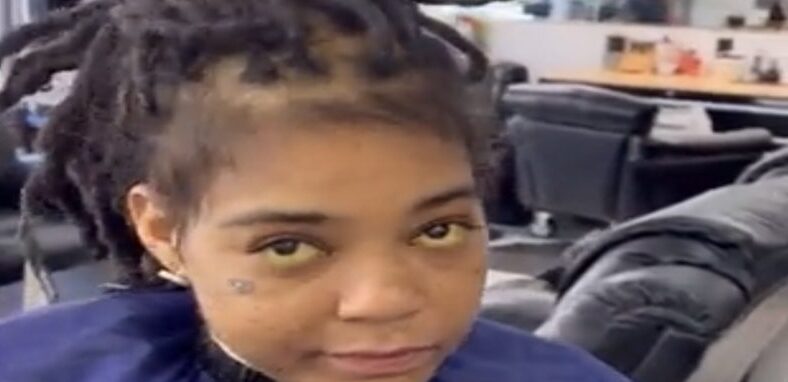 Young M.A's health is concerned by fans after noticing yellow eyes