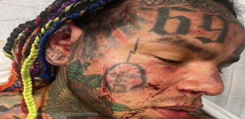 Tekashi 6ix9ine treated at hospital after LA Fitness attack