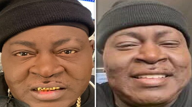 Trick Daddy replaced his famous gold teeth with veneers