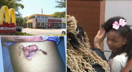 8-year-old girl awarded $800K after being burned by McNugget