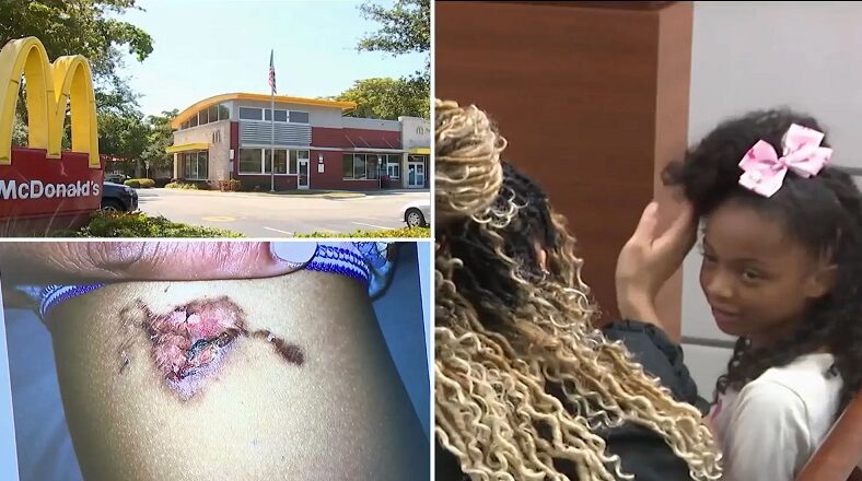 8-year-old girl awarded $800K after being burned by McNugget