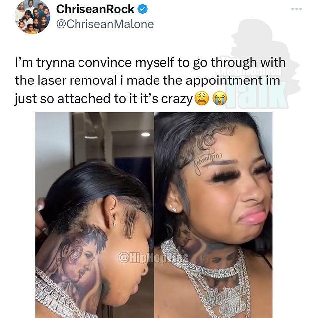 Chrisean Rock Is Getting Blueface Tattoo Removed From Her Neck