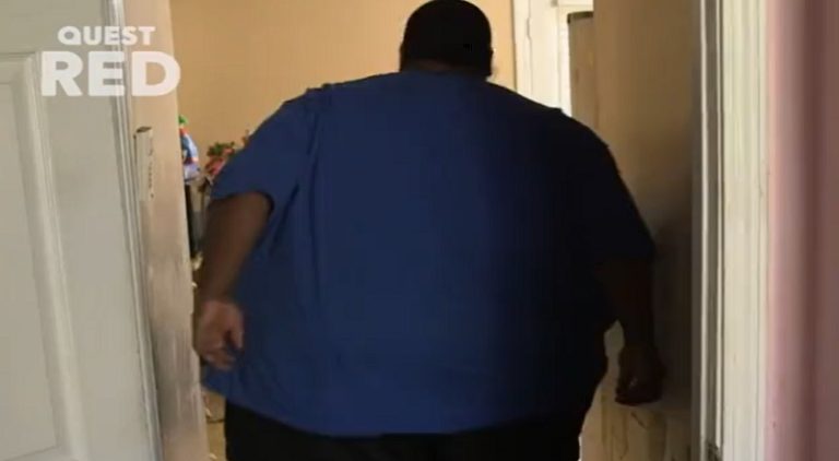 Massively obese man gets a lot of attention due to his weight