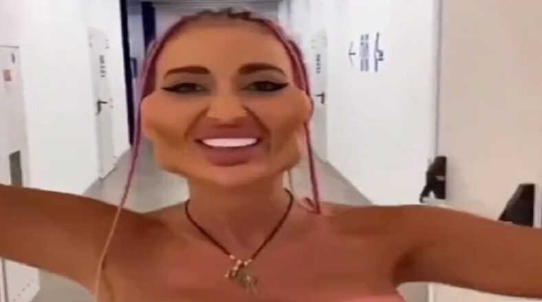 Woman's botched plastic surgery makes her face look animated