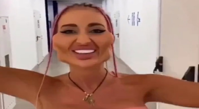 Woman's botched plastic surgery makes her face look animated
