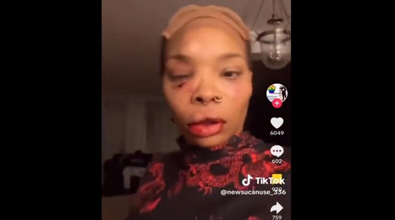 TikToker Deaf Bae says new girlfriend beat her up