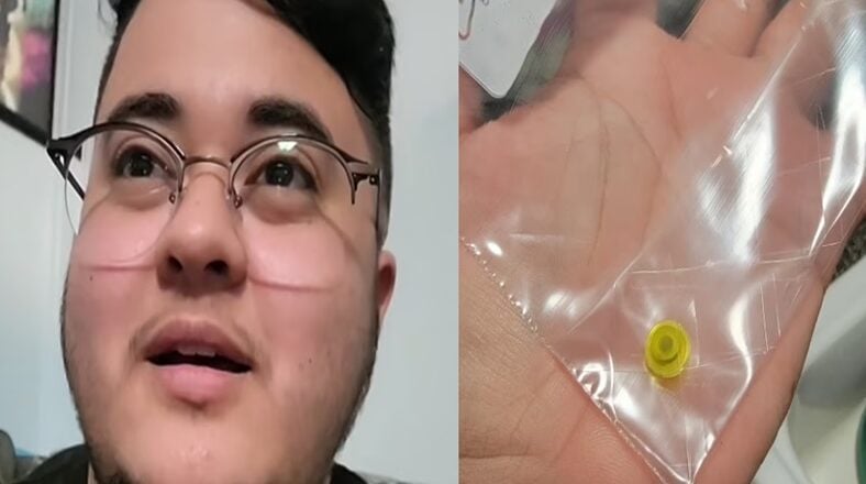 Arizona man sneezes out Lego stuck in nose for 25 years!
