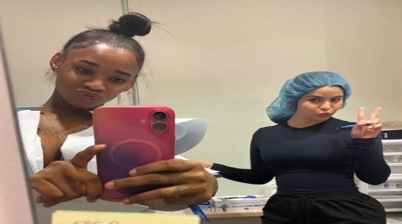 Sexyy Red reveals she underwent breast augmentation surgery